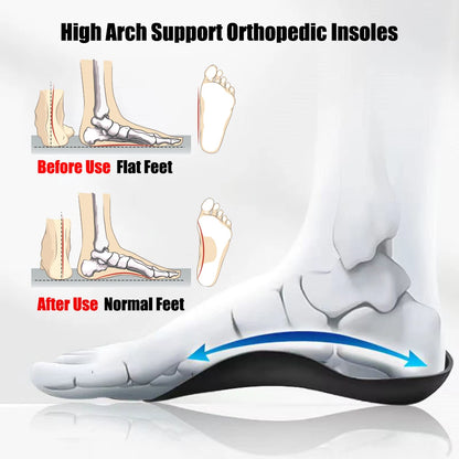 Orthotic Insoles for Plantar Fasciitis